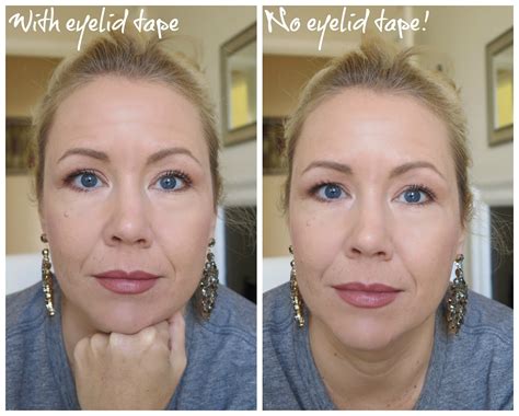 do eyelid tapes work|eyelid tape before and after.